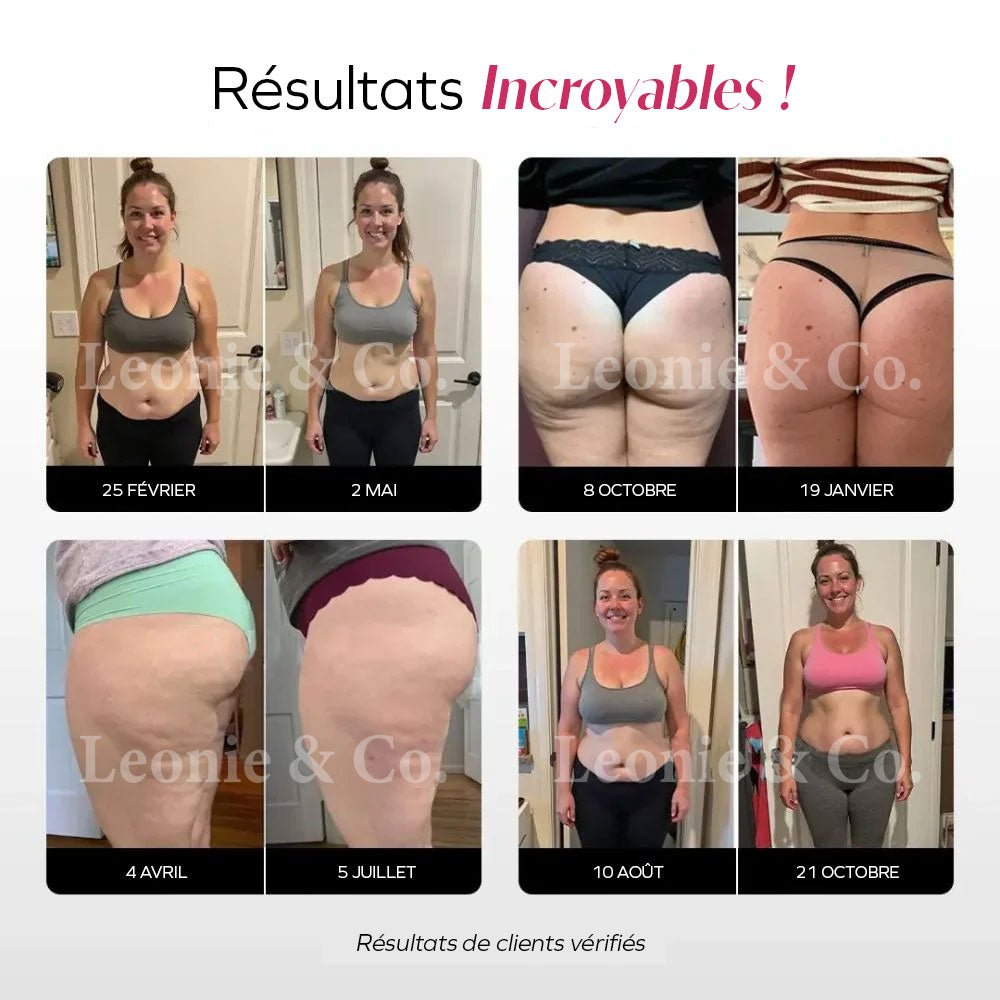 Sanfte Kompressions-Anti-Cellulite-3D-Leggings