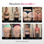 3D-Leggings entwässernd, gegen Cellulite – Kompressionsgewebe